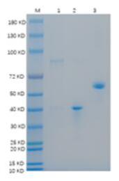 SDS-PAGE (RAD51-128H).jpg
